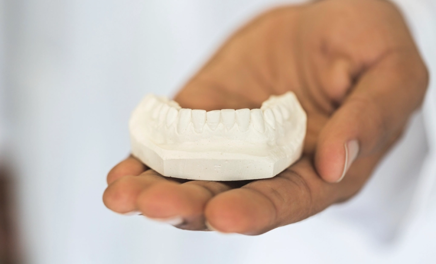 Dental Implants vs. Bridges vs. Dentures: Choosing the Right Tooth Replacement