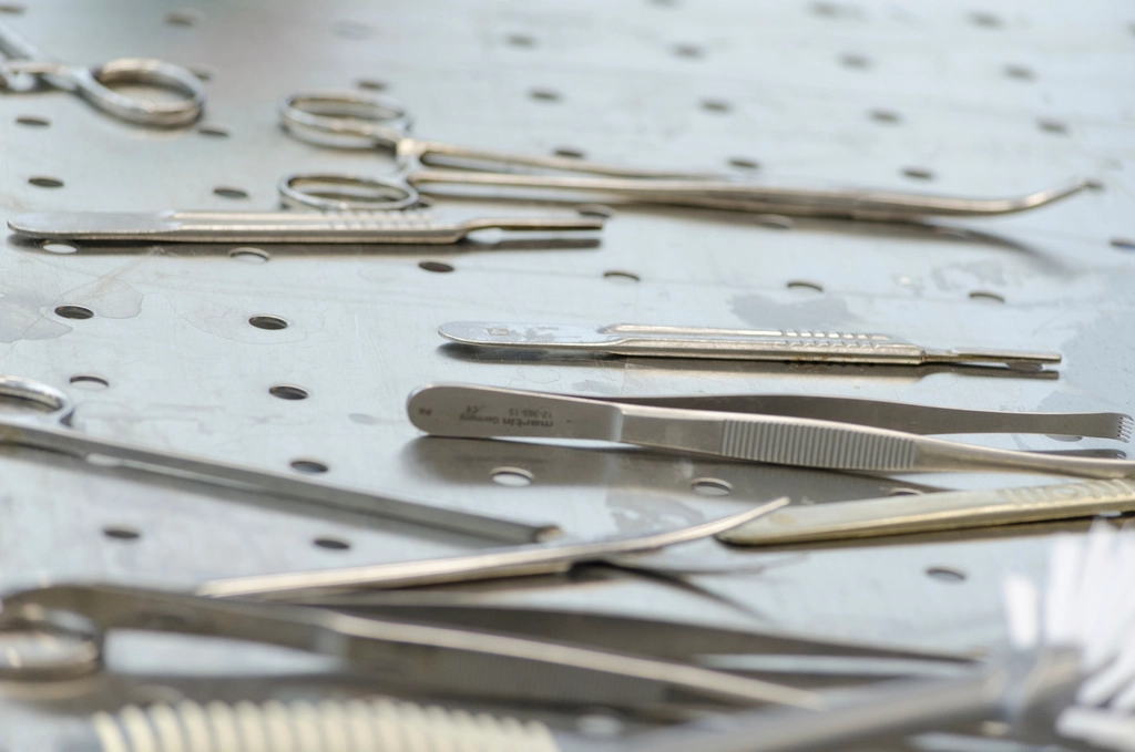 Why You Might Need a Tooth Extraction Even Without Pain