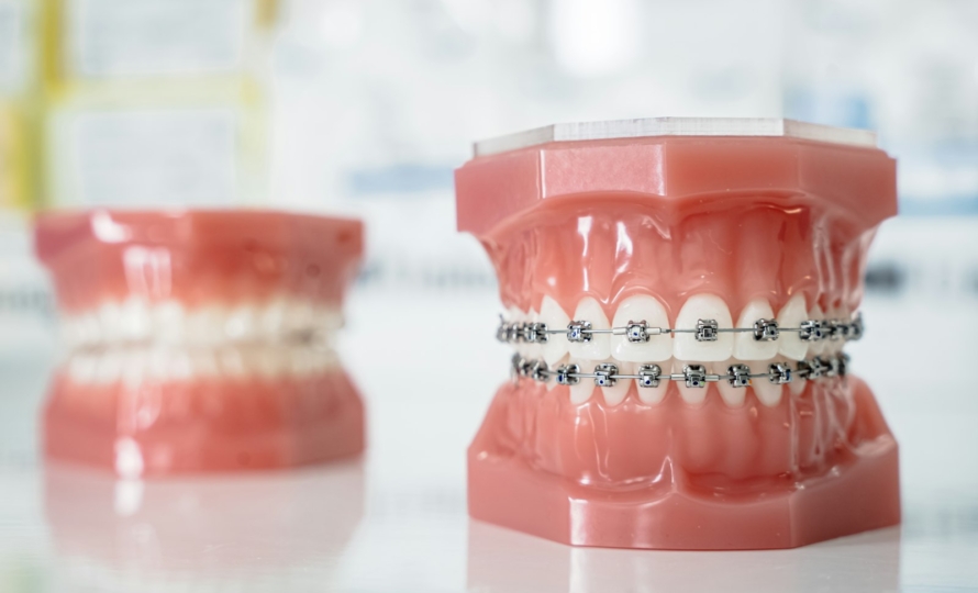 Adult braces at Michiana Family Dental in South Bend, IN