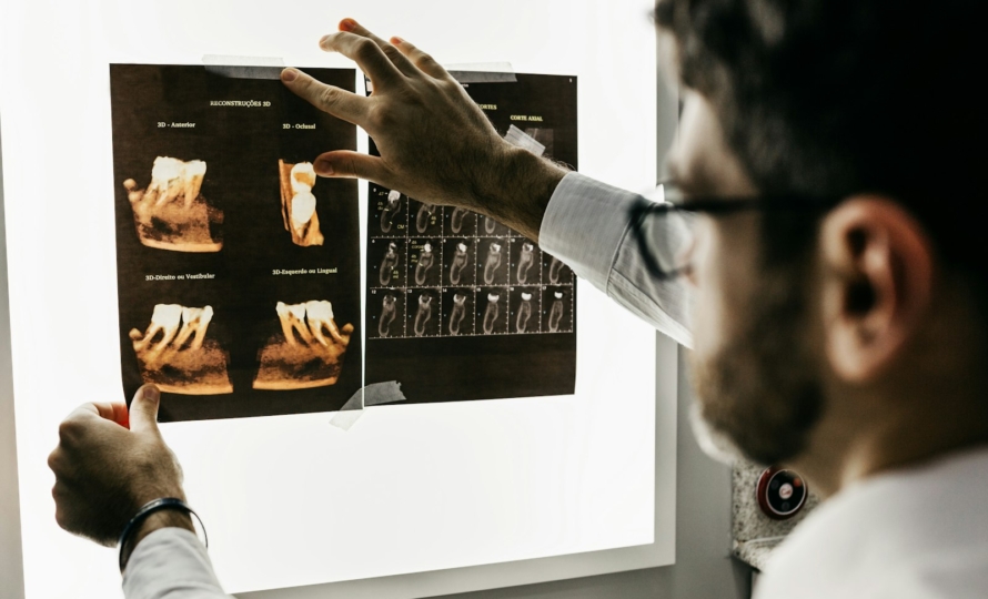 Dental x-rays at Michiana Family Dental in South Bend, IN
