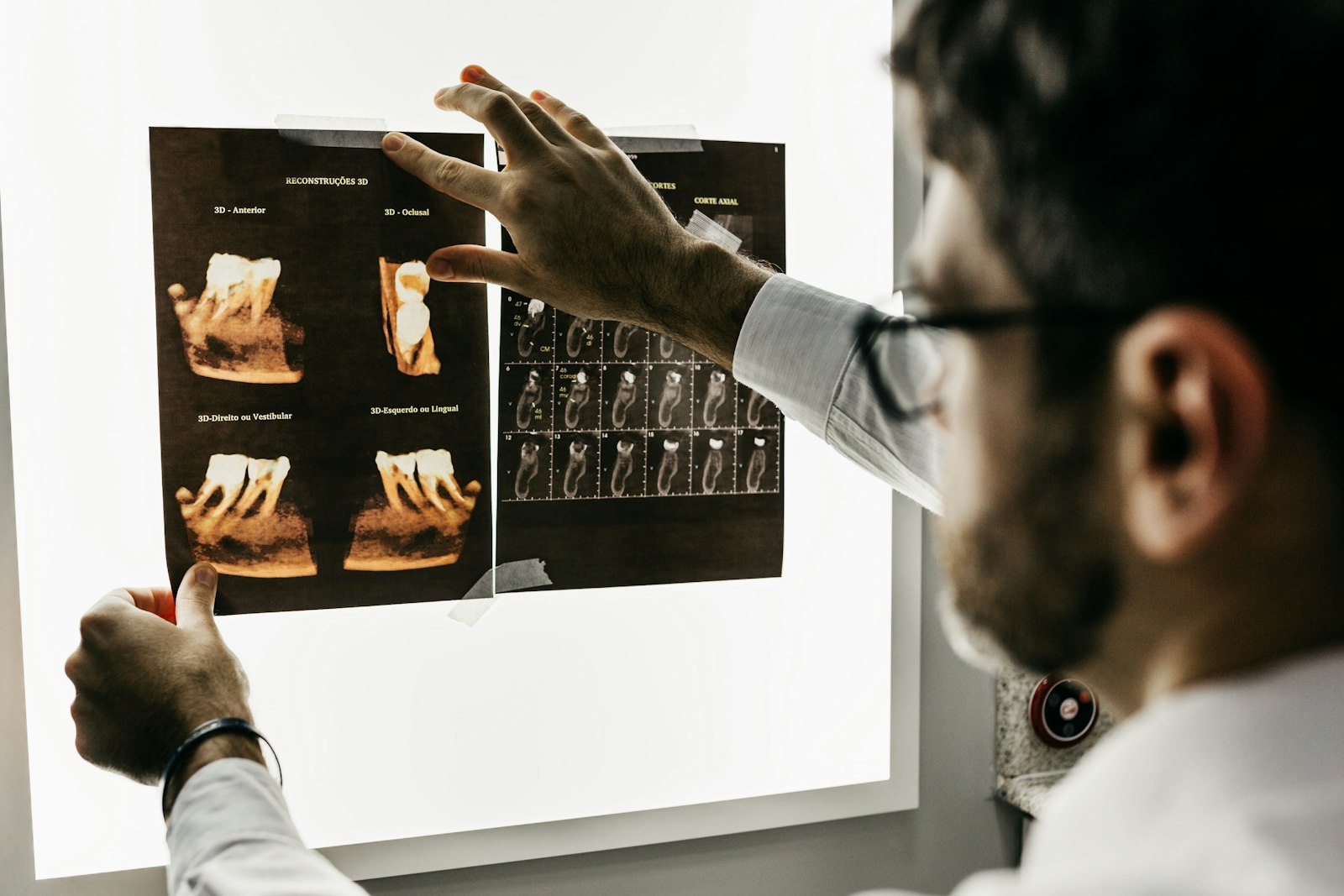 Dental x-rays at Michiana Family Dental in South Bend, IN