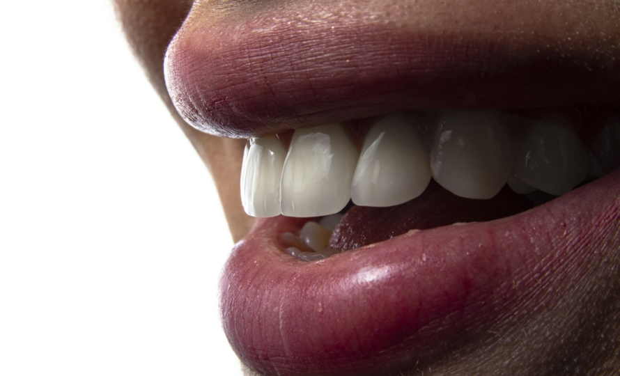 Cracked tooth at Michiana Family Dental in South Bend, IN