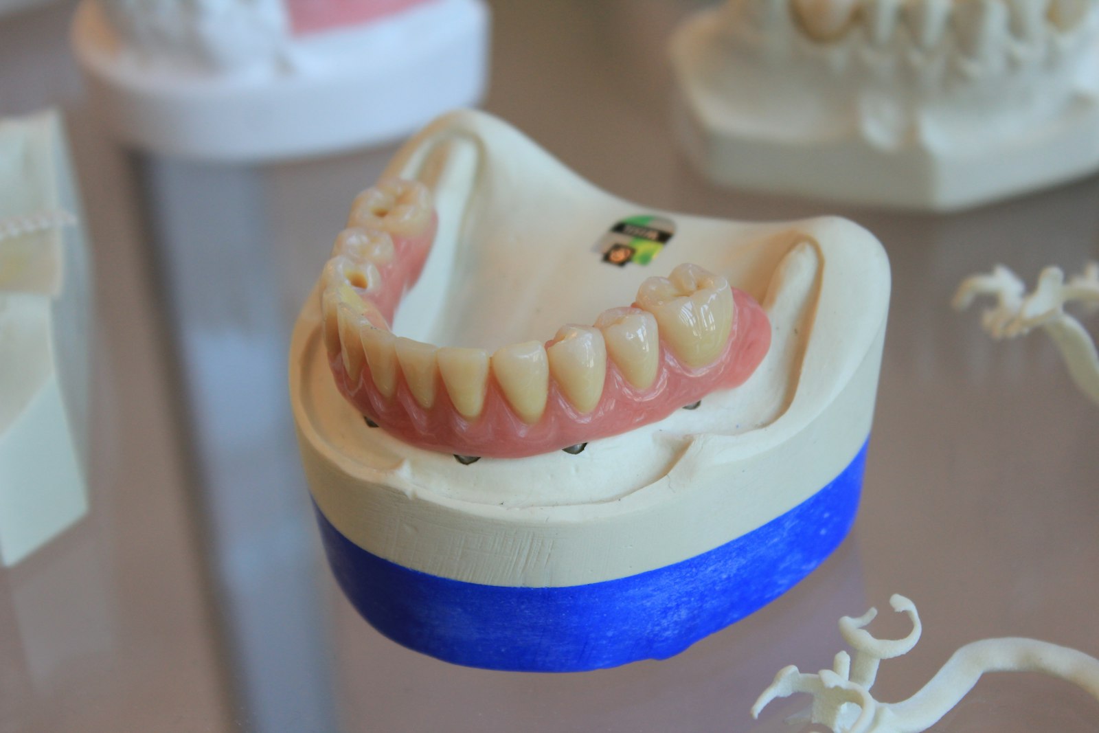Implant-supported dentures at Michiana Family Dental in South Bend, IN