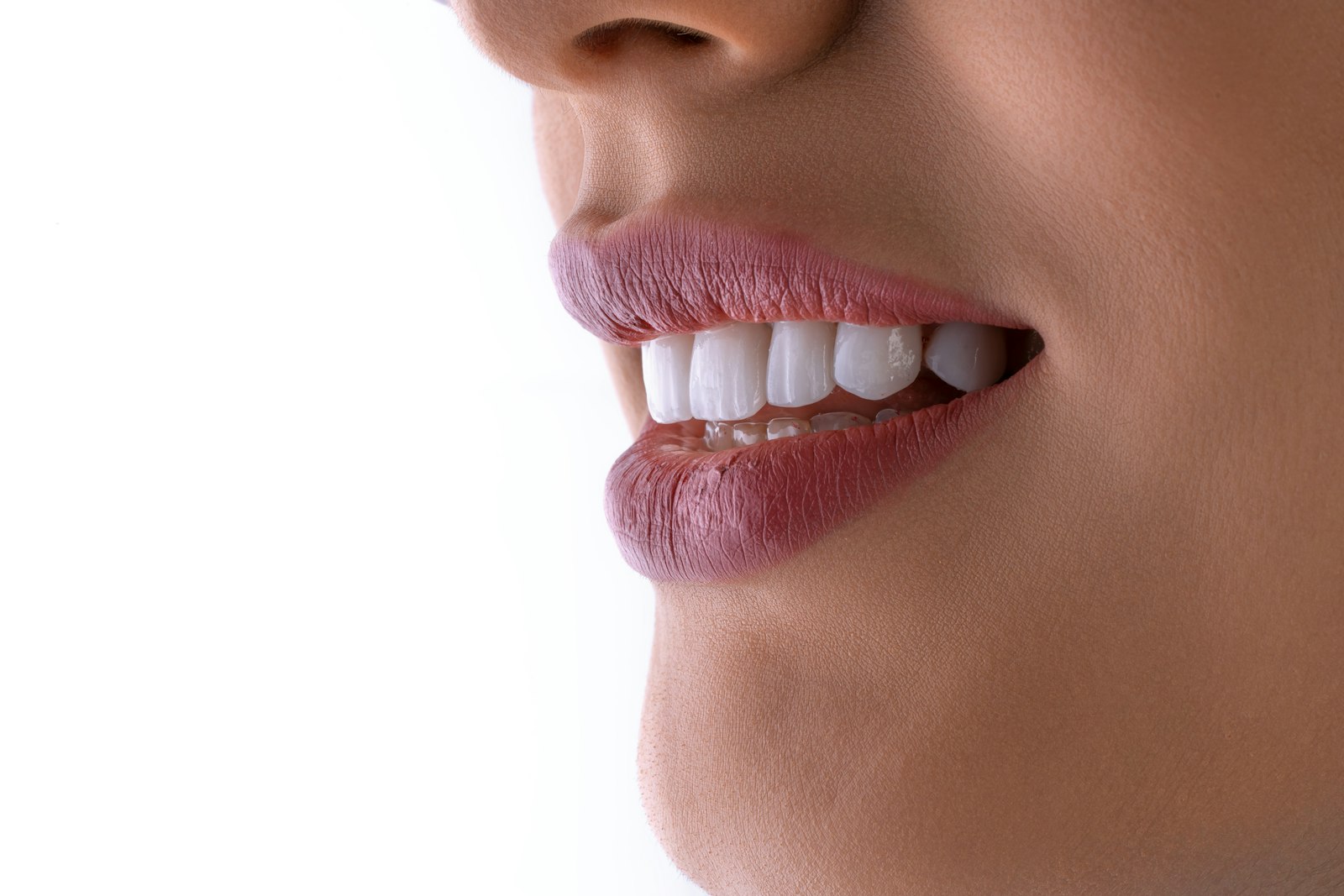 Porcelain veneers at Michiana Family Dental in South Bend, IN